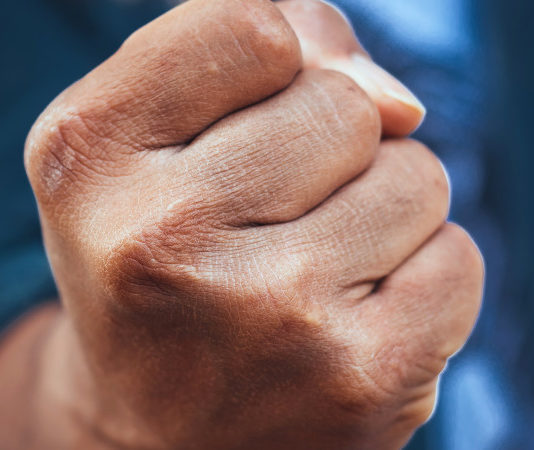 Litiga con i vicini per una servitù prediale e perde il porto d’armi Litigio con vicini